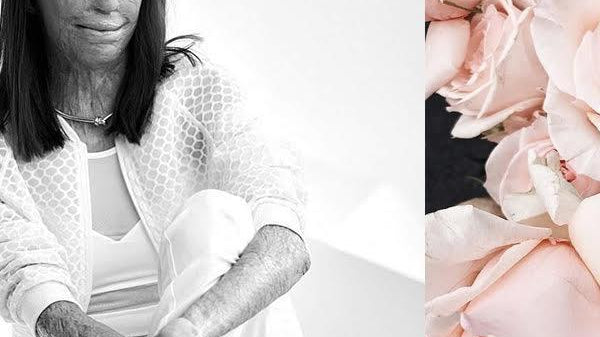 Woman of the Month: Turia Pitt-ESTHER & CO.